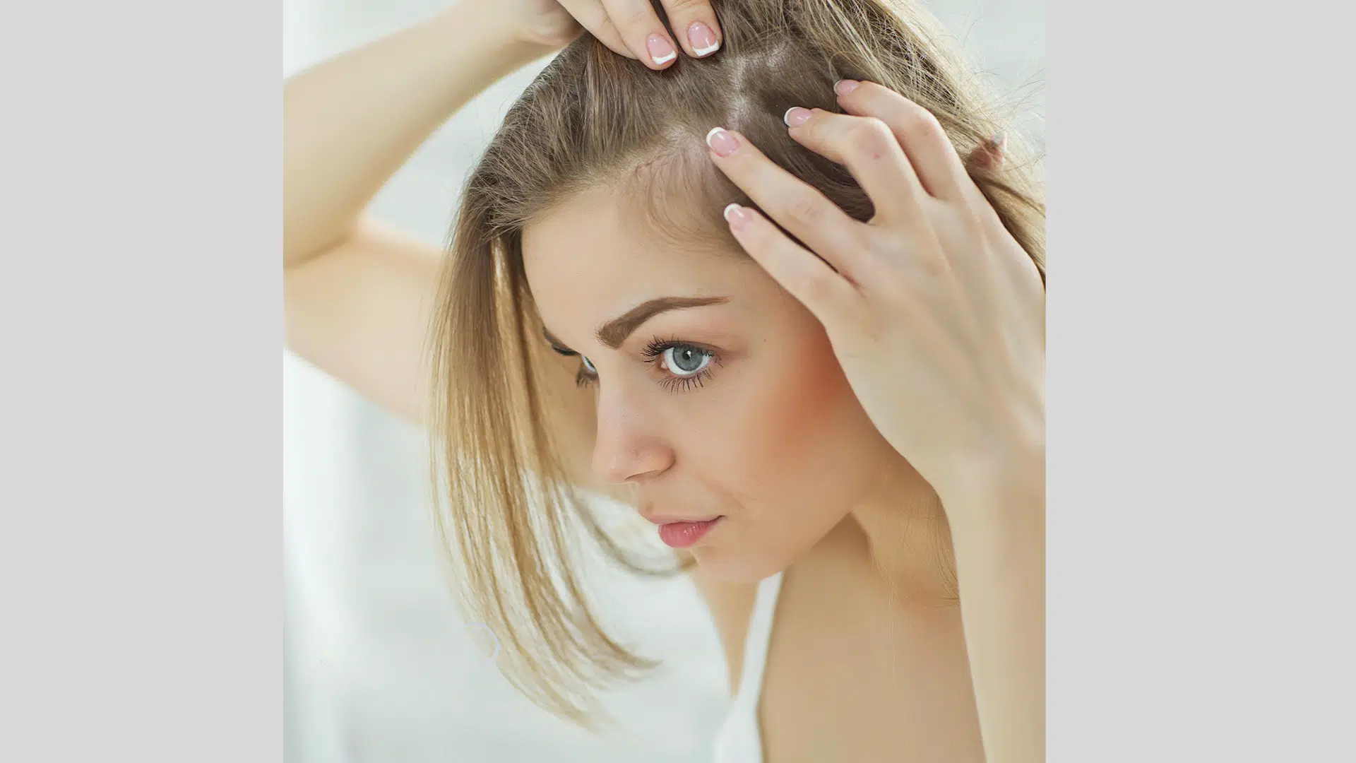 Hair Loss