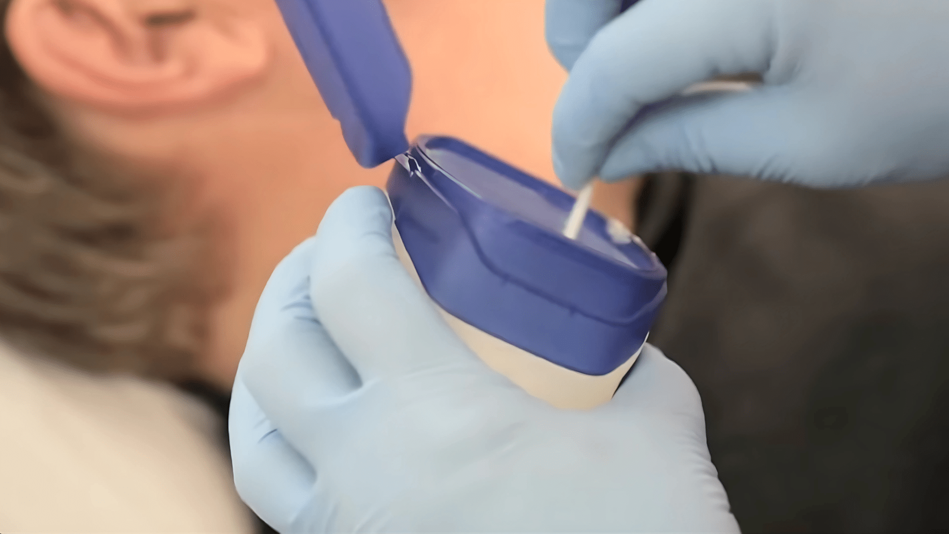 Step 3 Post-Removal Care