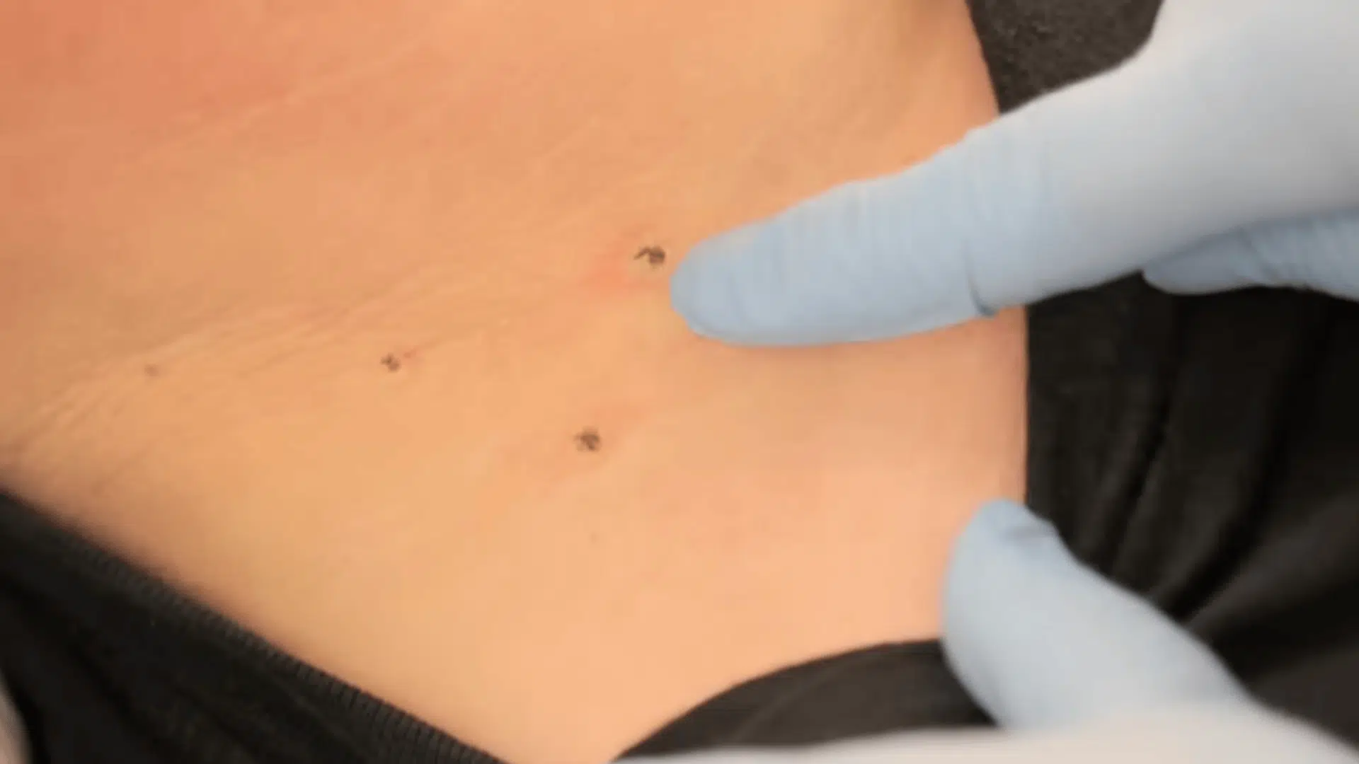 Step 4 Aftercare Advice