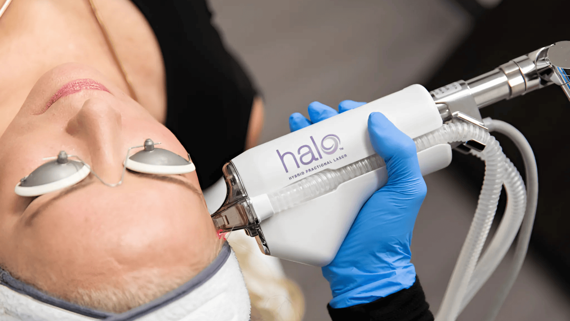 Top-Benefits-and-Key Facts-About-HALO-Laser-Treatment