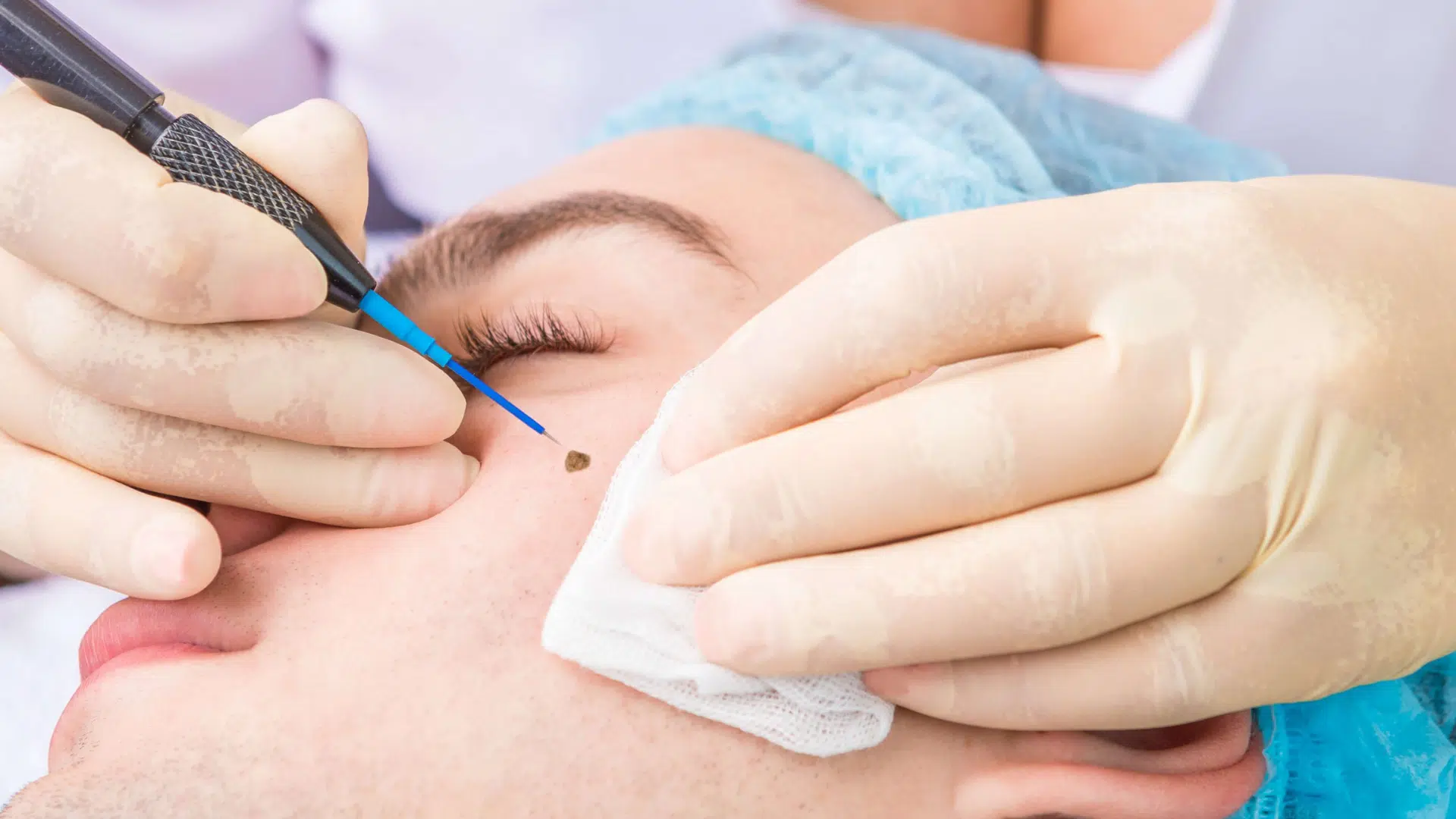 When to Seek Professional Help