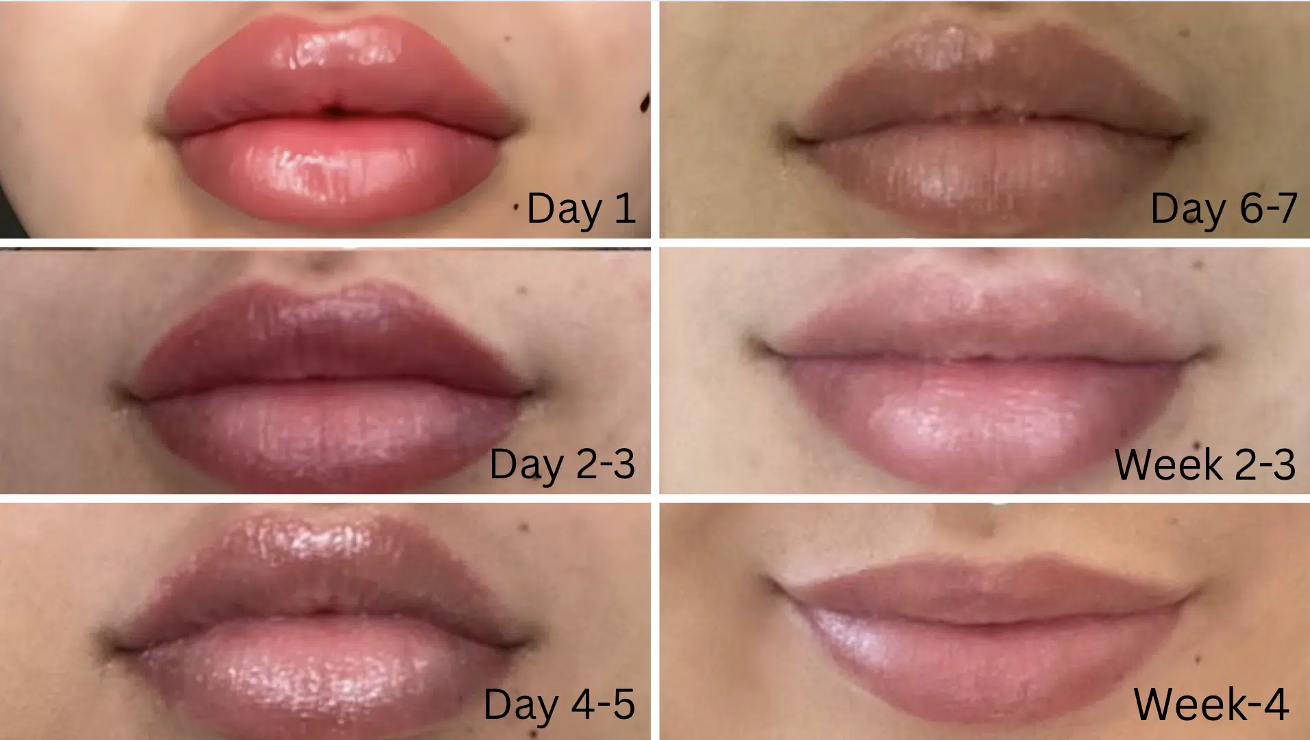 lip blush healing