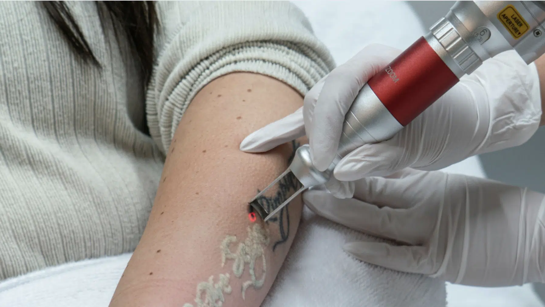 PicoWay Tattoo Removal: How It Works - Beauty And Blog