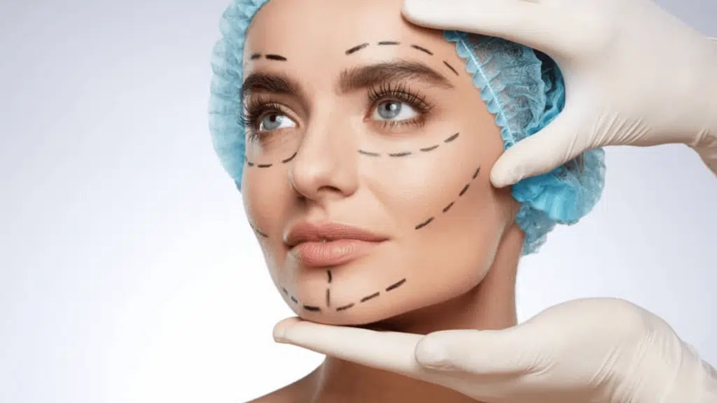 plastic surgery before and afte