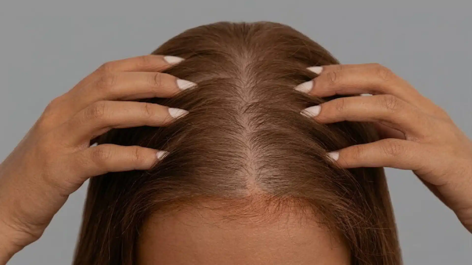 Woman showing visible hair thinning along part line with widened scalp area and reduced hair density near roots