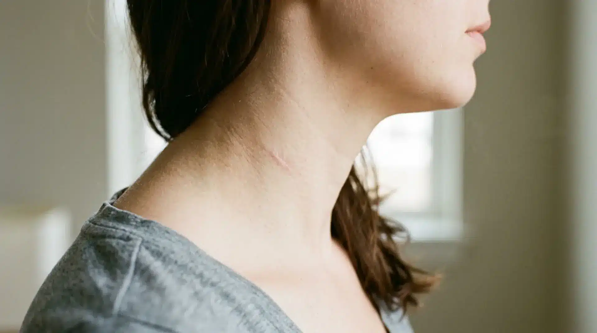 Close up of neck with small healed mole removal scar, showing light pink mark and smooth surrounding skin texture