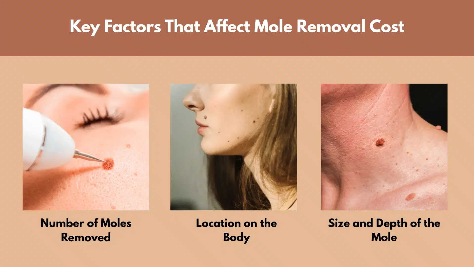 Infographic showing factors affecting mole removal cost including number, location and size of moles