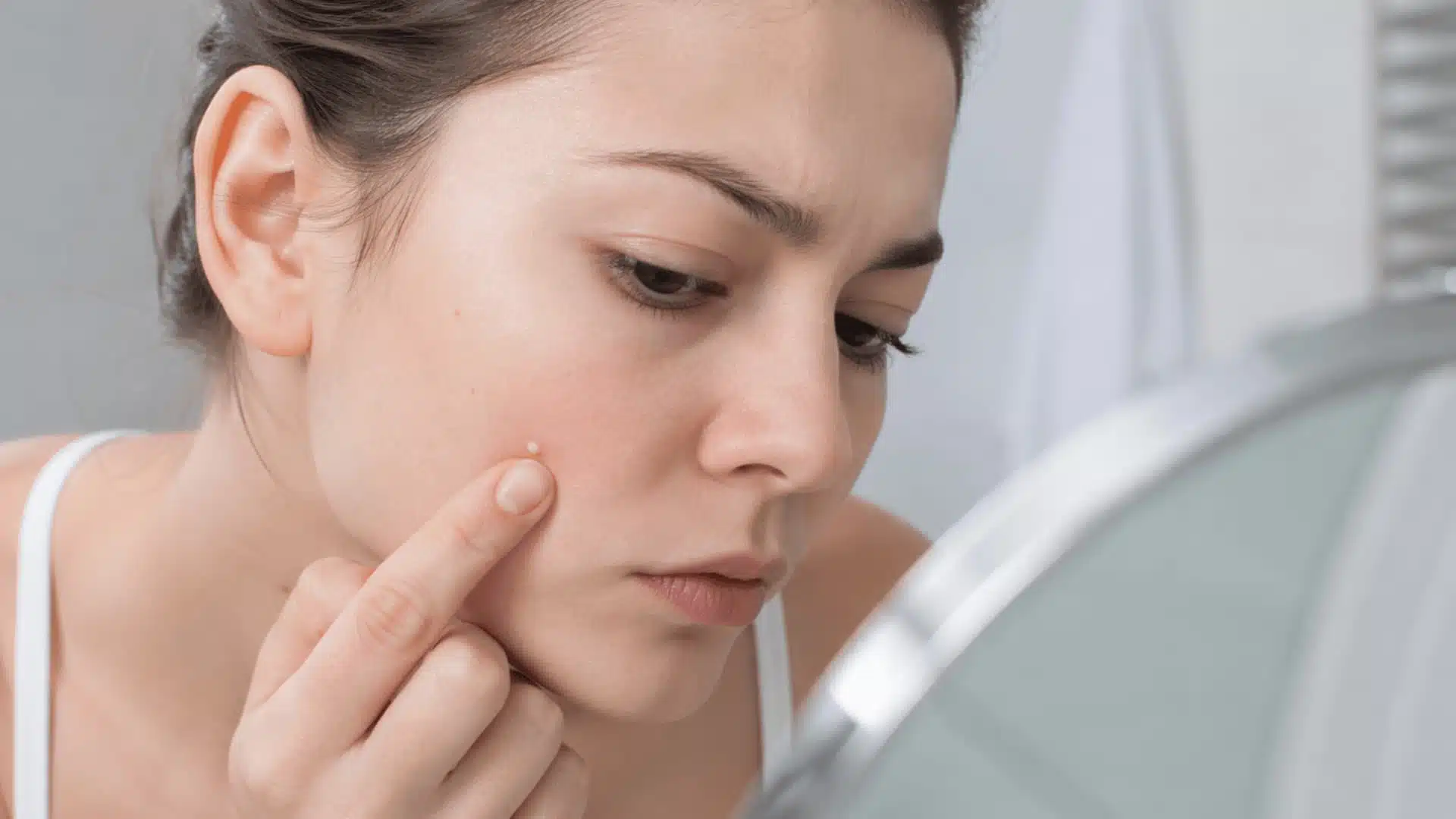 Woman examining a small whitehead on her cheek in a mirror