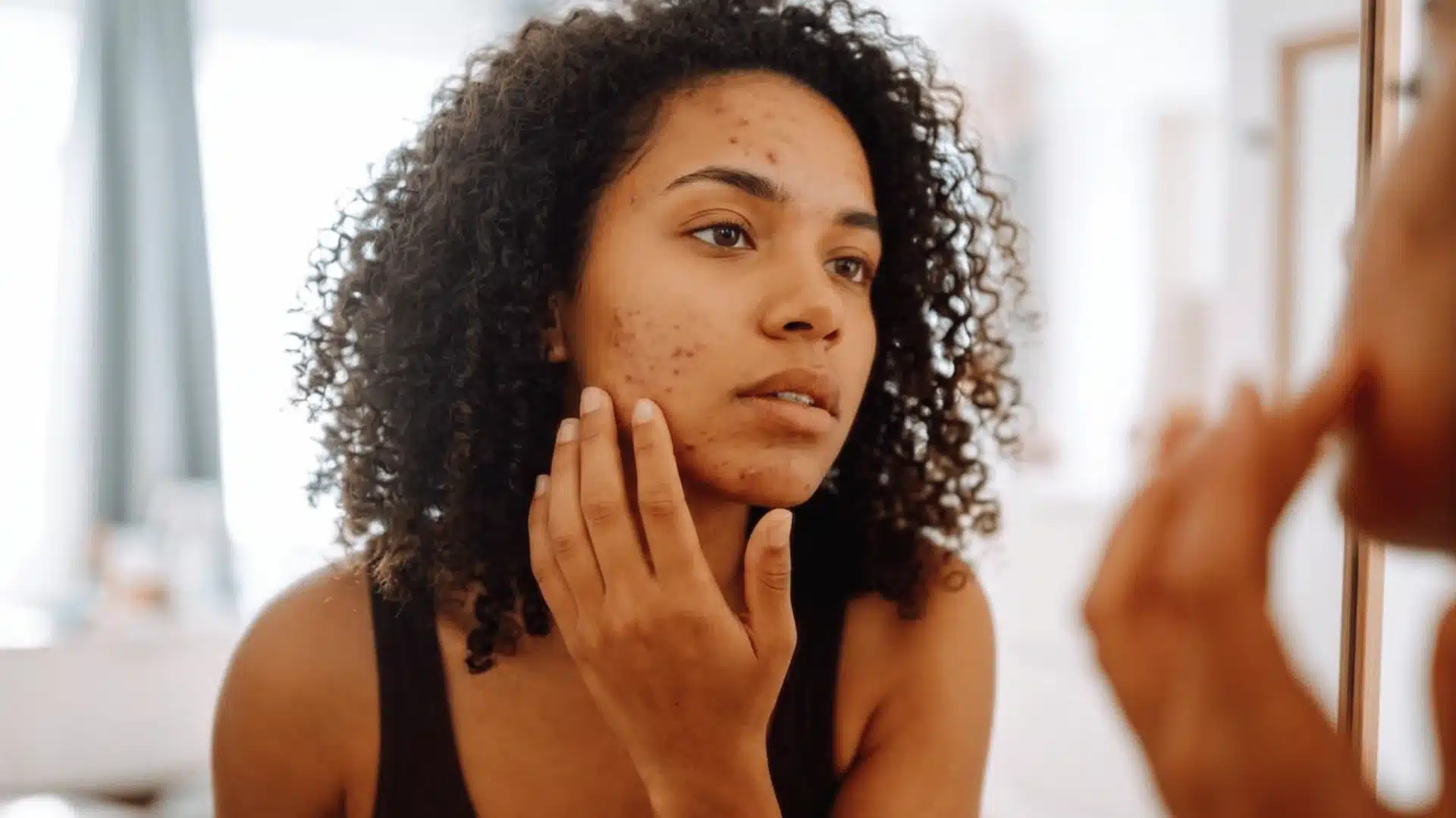 Young woman with curly hair looking in a mirror, touching her face and examining her skin's acne