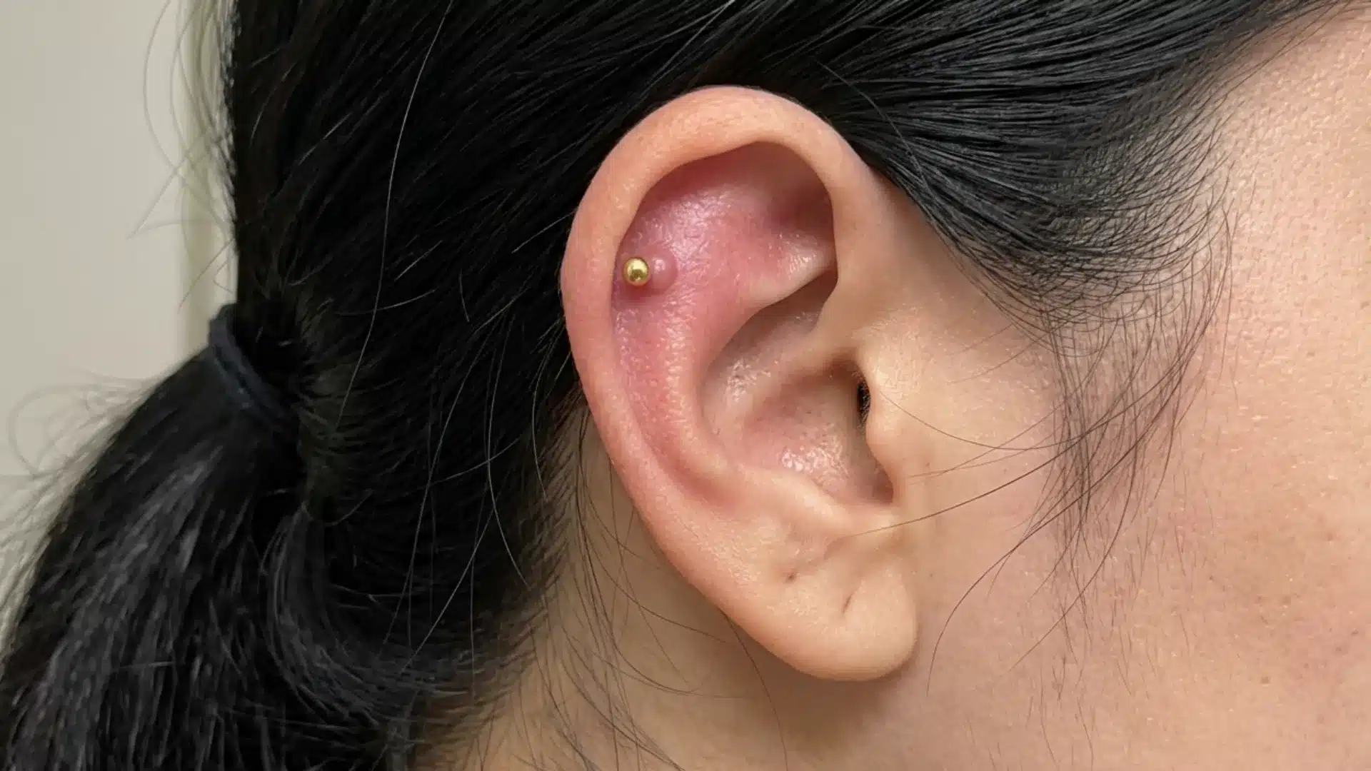 Close-up of a cartilage piercing with a small pink bump around a gold stud on the upper ear