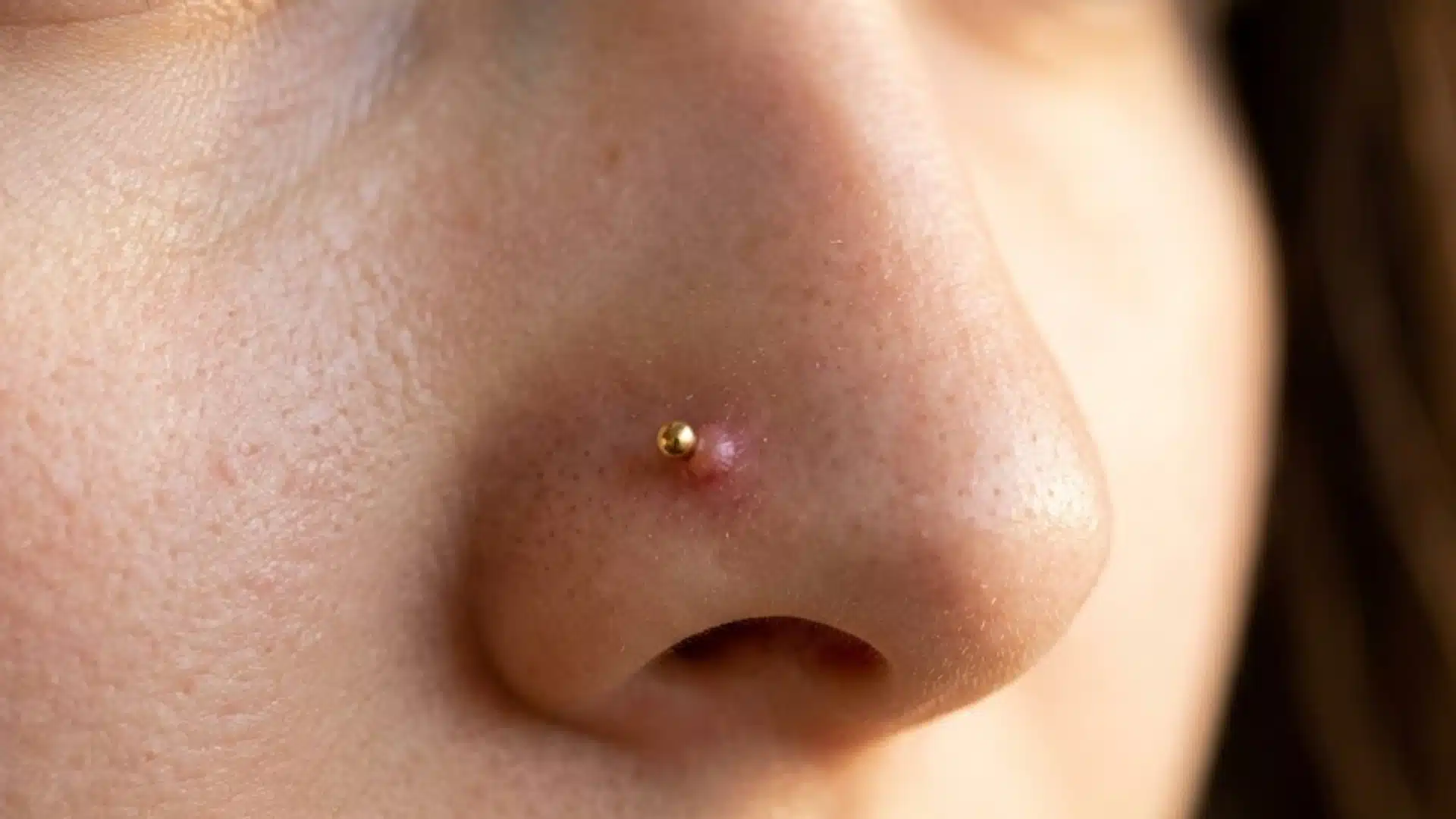 Close-up of a nose piercing with a small pink irritation bump beside a gold nose stud during healing process