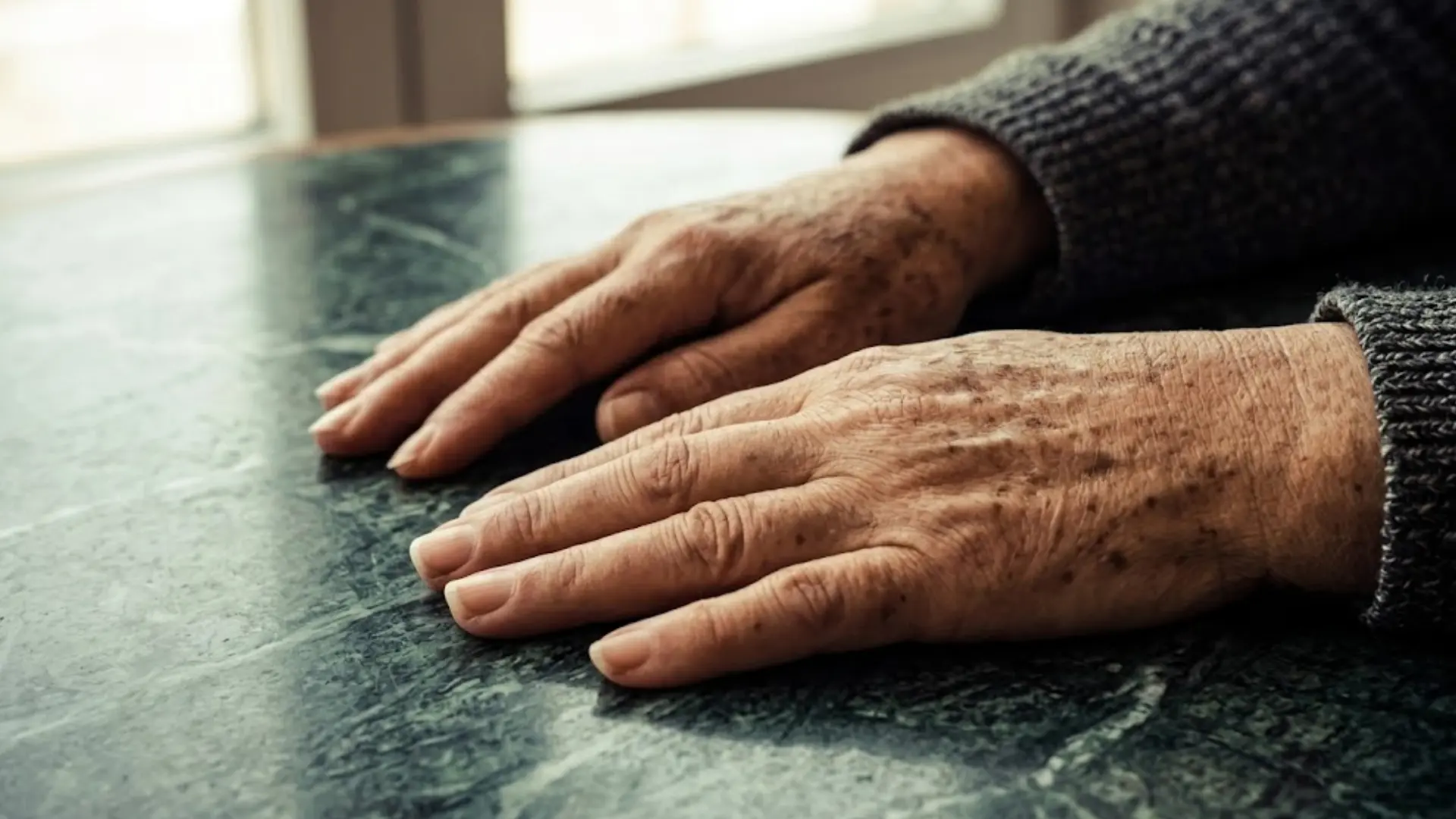 Elderly hands resting on a dark table with multiple brown age spots and sun damage