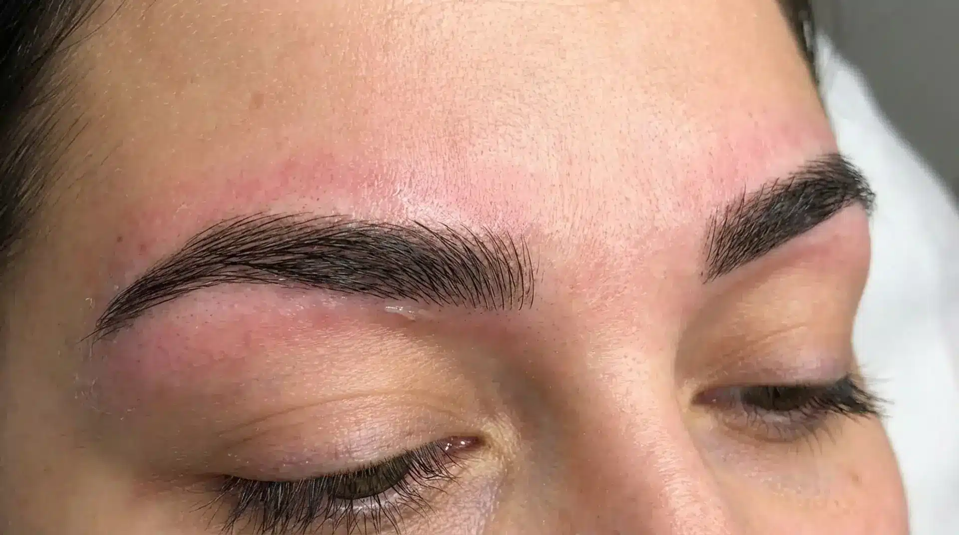 Healing microbladed brows showing redness and slight irritation during early recovery stage