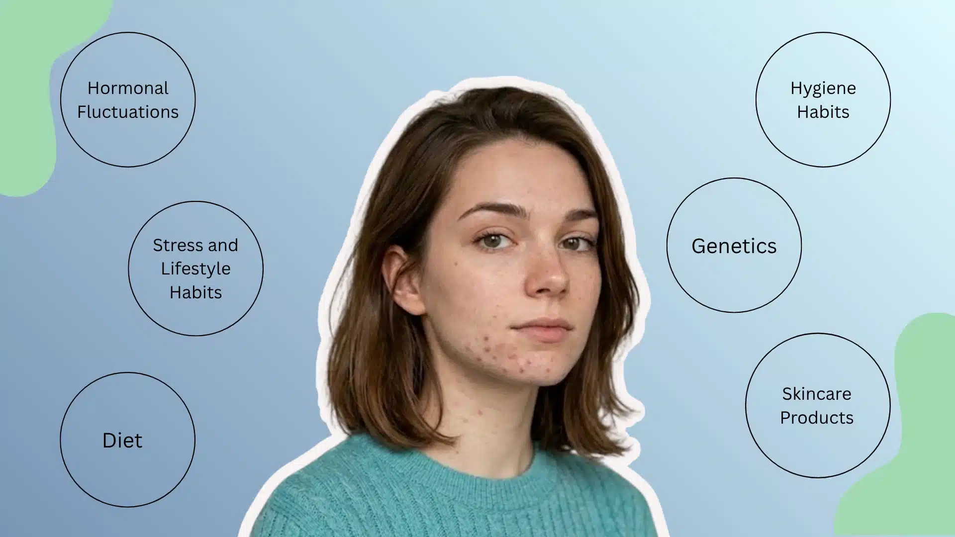 Illustration of woman with chin acne surrounded by causes like hormones, stress, diet, hygiene, skincare, and genetics