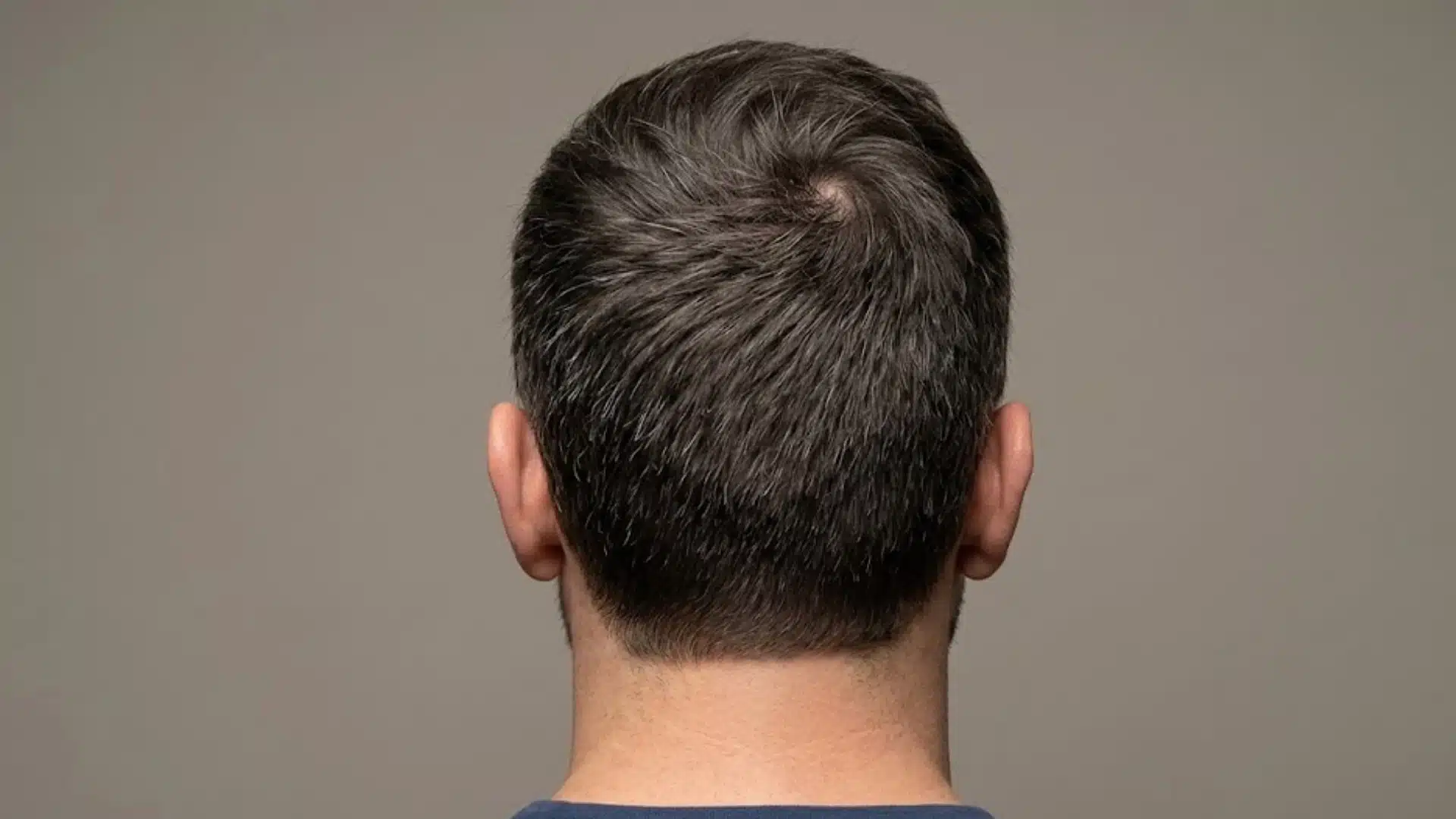 Back view of a man showing a crown cowlick with hair swirling naturally around the scalp center