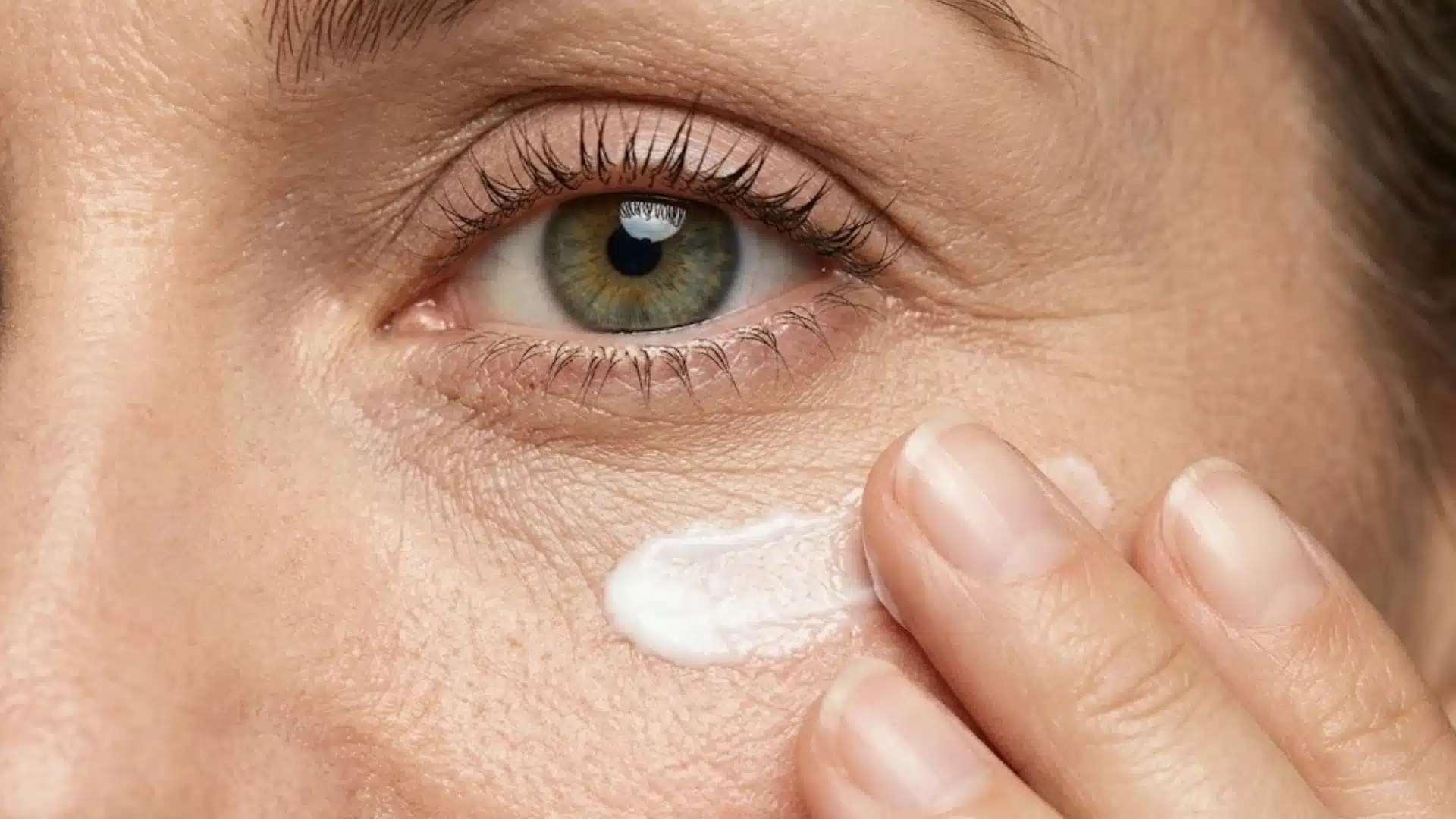 Close-up of eye cream applied under the eye to soften wrinkles, dryness, and fine lines around delicate skin