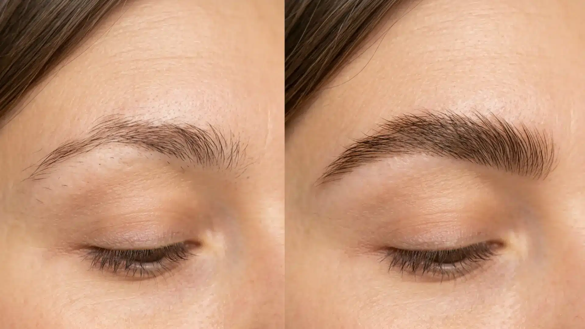 Eyebrow regrowth stages over time