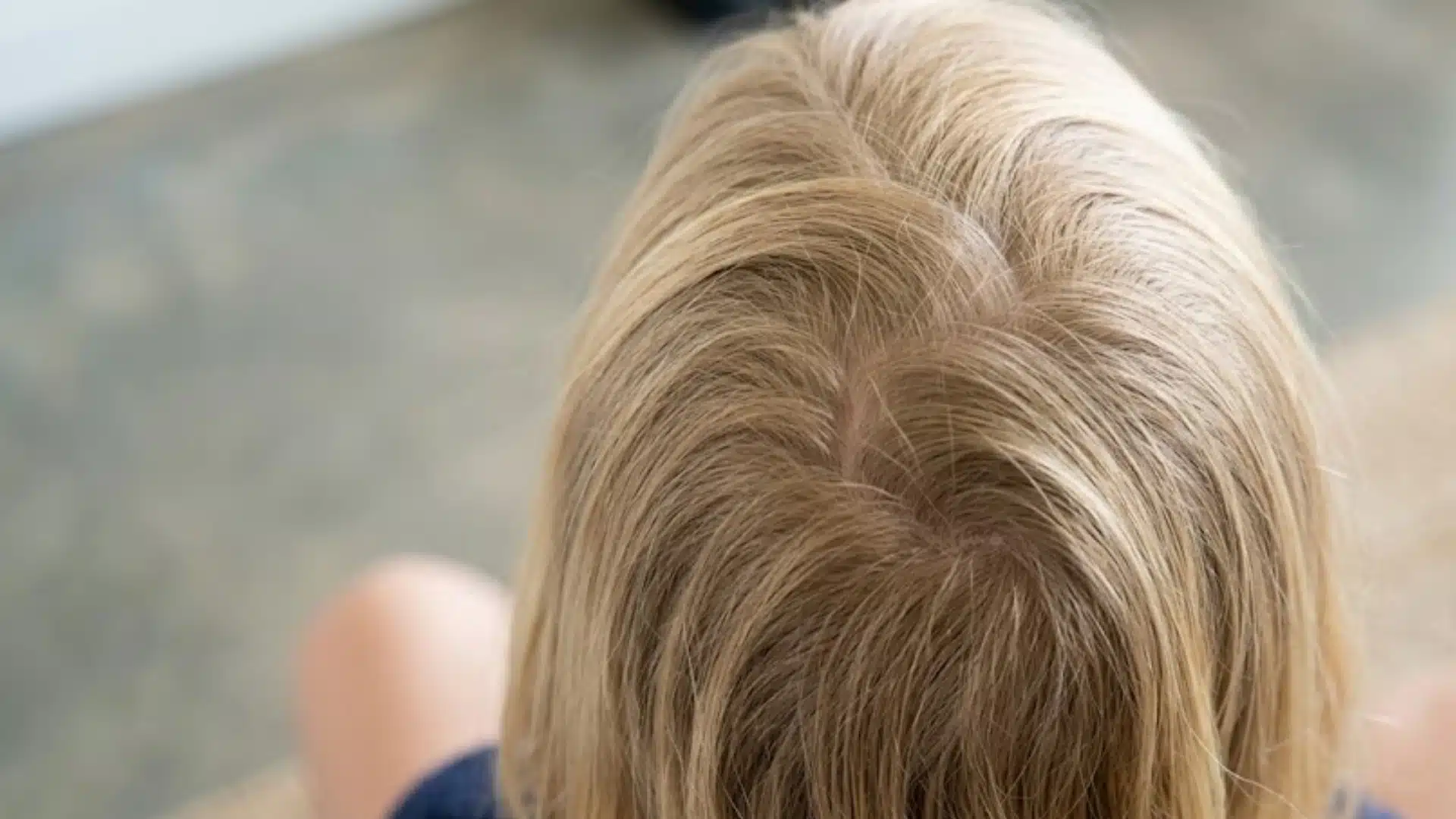 Top view of blonde hair showing a natural crown cowlick and uneven strands spreading across the scalp