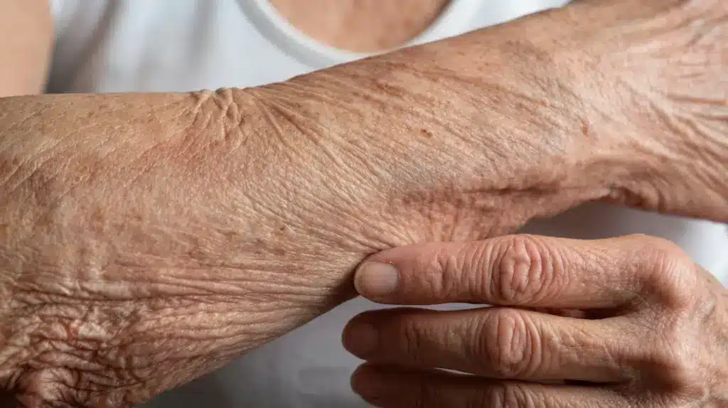 close up of crepey skin on an older arm showing thin wrinkled texture and fine lines