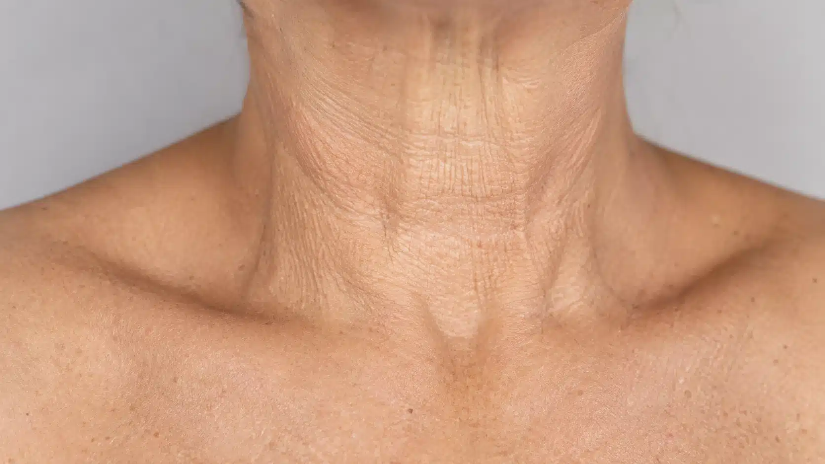 close up of neck and chest crepey skin showing fine wrinkles folds and reduced skin elasticity