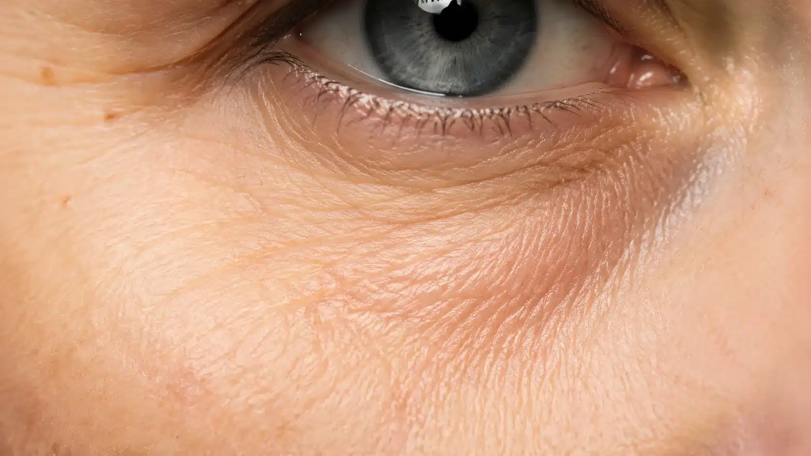 close up of under eye crepey skin showing fine lines wrinkles and delicate natural aging texture