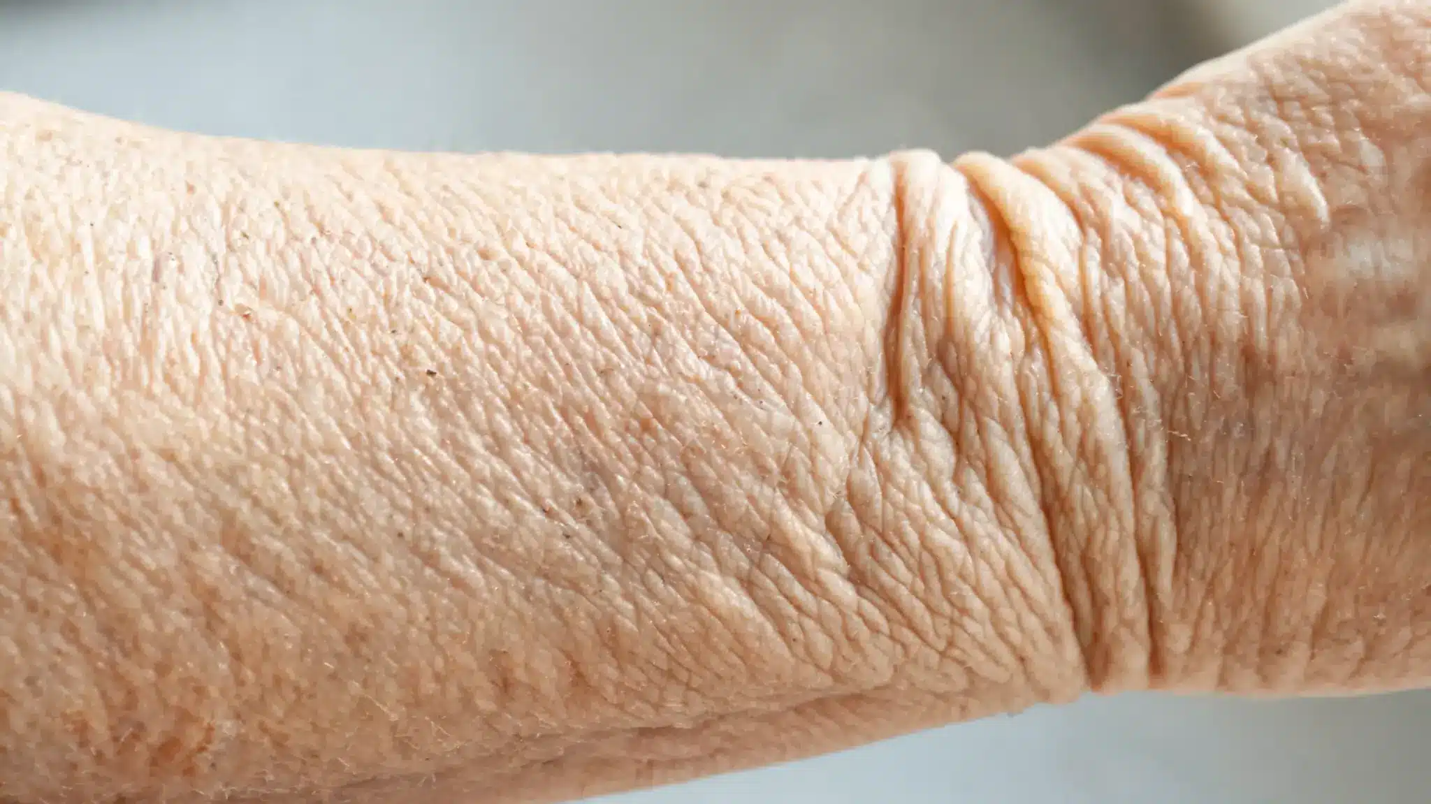 close up view of crepey aging skin texture showing fine wrinkles and natural skin folds on an arm