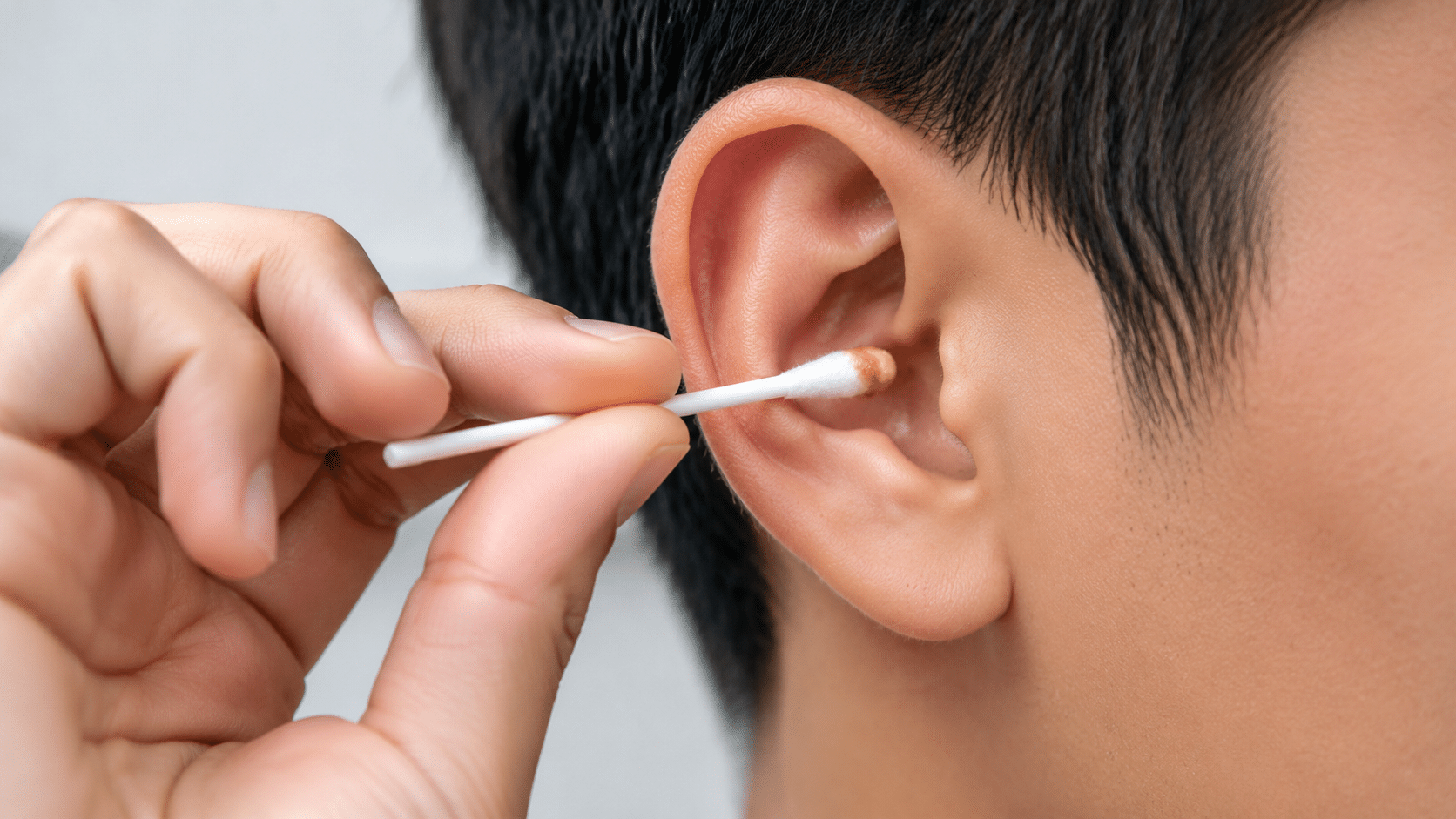 removing excess earwax causing dry itchy ear canal